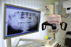 Dental xray